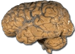 Quelle: http://commons.wikimedia.org/wiki/File:Human_brain_NIH.png